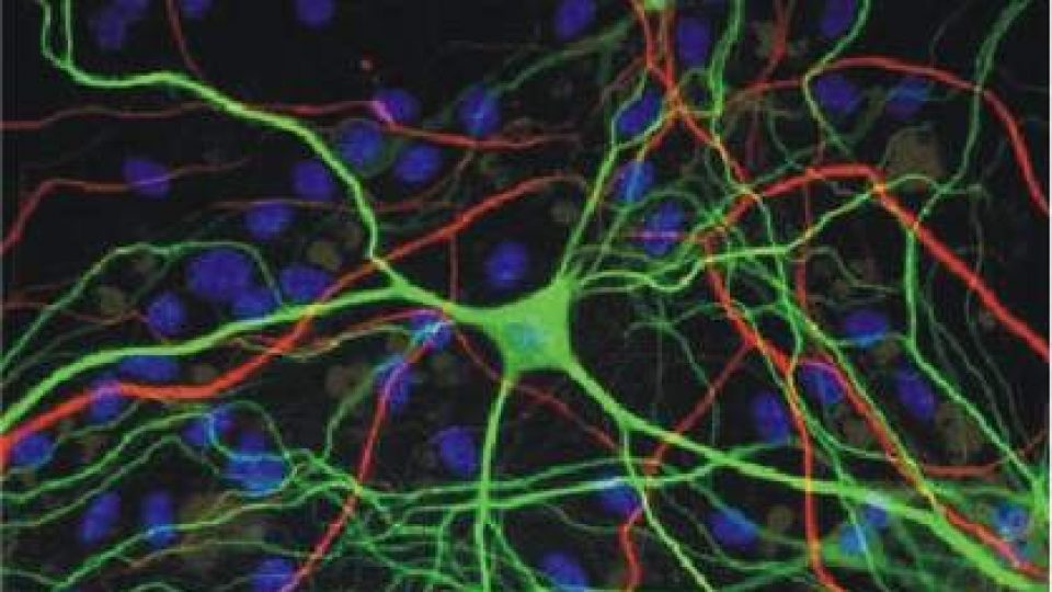 70. Mozkové buňky pracují s počítačovým čipem